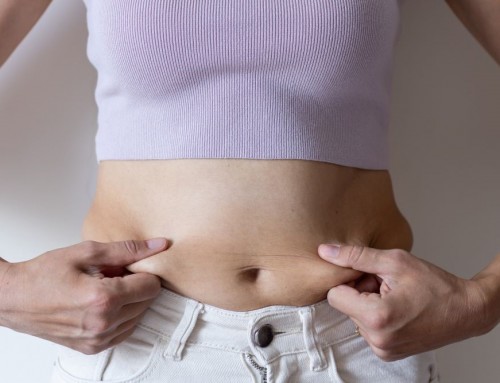 Tummy Tuck Vs. Coolsculpting: Which Should You Choose?