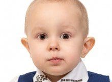 Otoplasty Ear Tuck Surgery