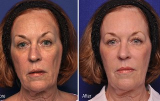 A woman with an older look and wrinkles on her face.